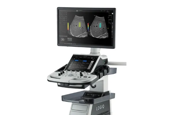 LOGIQ P10 초음파